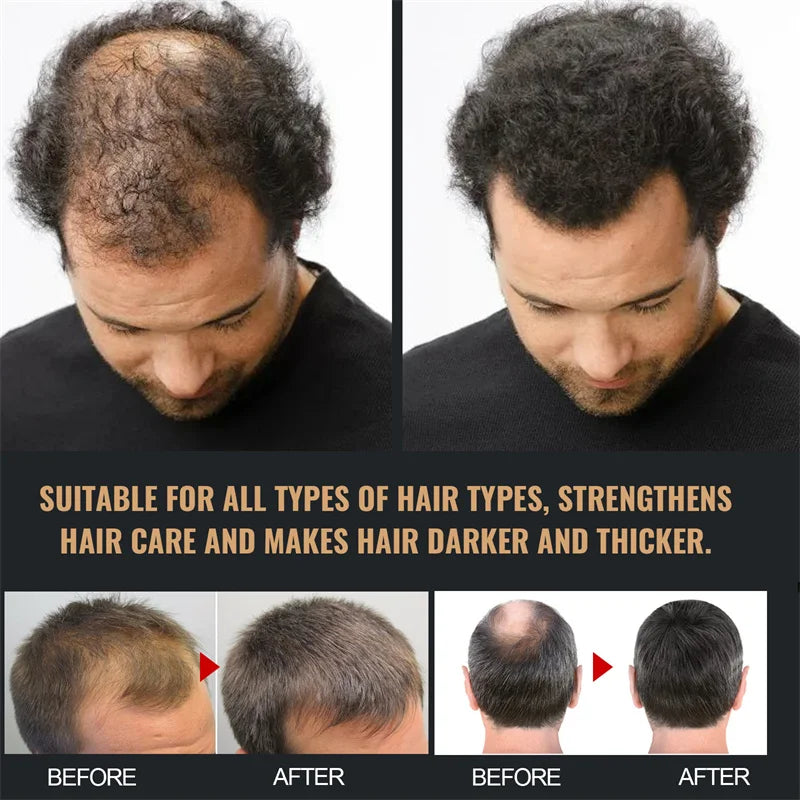Universal Hair Growth Shampoo