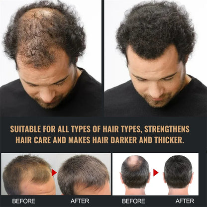 Universal Hair Growth Shampoo